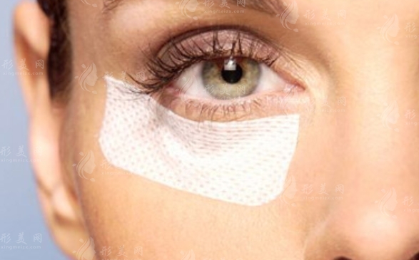 去眼袋手術：維持時間與費用全解析