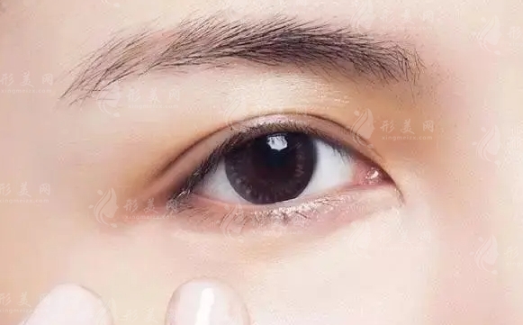 如何去除淚溝：醫(yī)美方法詳解