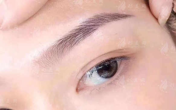 專家解讀提眉和切眉的本質(zhì)區(qū)別