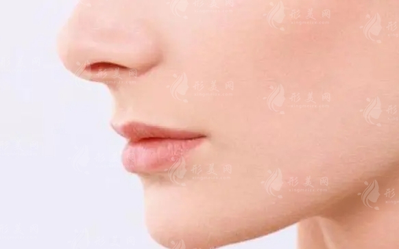 鼻翼缺陷修復(fù)的優(yōu)缺點(diǎn)分析