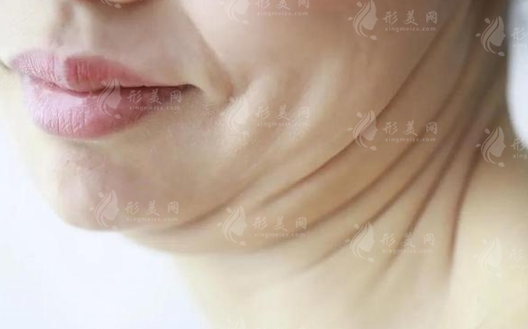 如何快速去雙下巴？去雙下巴的方法有哪些？
