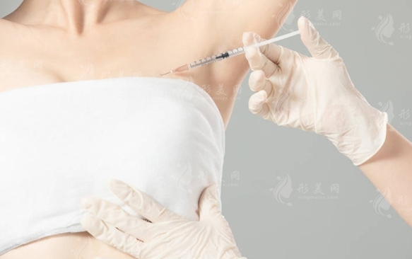 自體活細(xì)胞脂肪隆胸：效果如何？存在風(fēng)險(xiǎn)嗎？