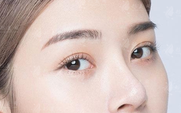 膨體隆鼻感染的癥狀與處理