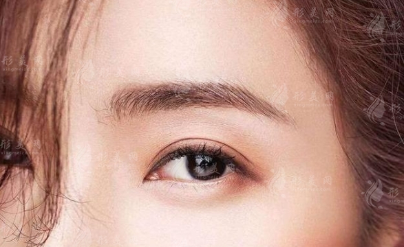 硅膠假體墊眉弓會移位嗎？如何預(yù)防？