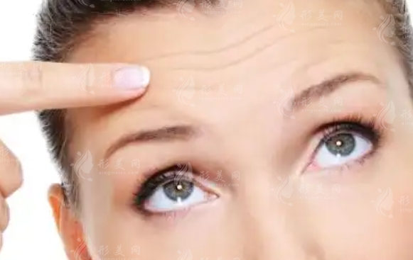 手術(shù)去除眉間紋：安全與注意事項
