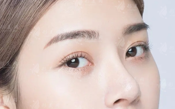 為什么很多人隆鼻多年后會塌陷？注意事項一覽