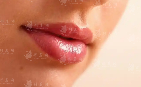 厚唇改?。夯謴?fù)時間與手術(shù)風(fēng)險全解析