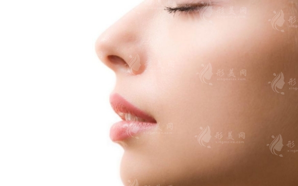 做個(gè)鼻梁需要多少錢？有沒(méi)有風(fēng)險(xiǎn)？