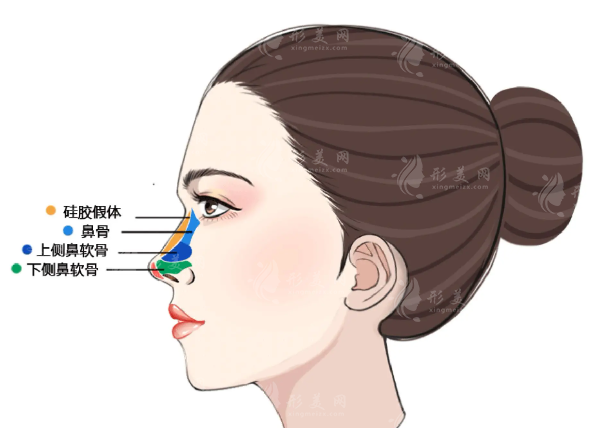 文豐隆鼻有黑料嗎？深圳藝星自然鼻技術全解析