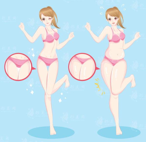 北京吸脂修復(fù)價(jià)格揭秘：前十醫(yī)院醫(yī)生+避坑指南