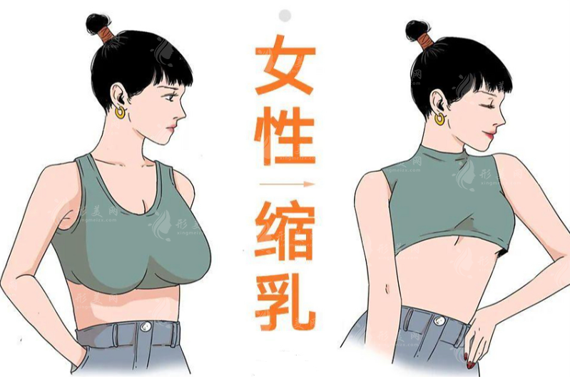 廣州縮胸手術(shù)價(jià)格2026大揭秘：2萬(wàn)到15萬(wàn)差價(jià)全解析
