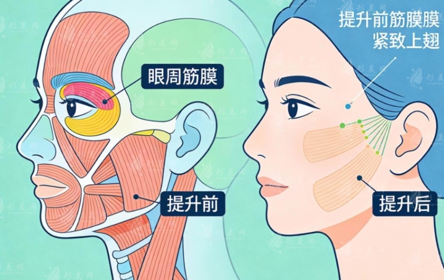 2026北京無痕筋膜提升價格全曝光！多少錢才合理