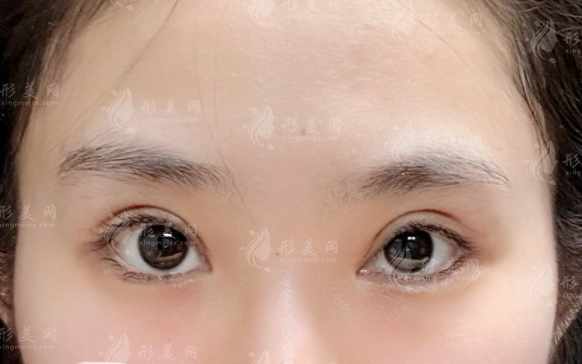 武漢王海平和項利姣眼修復(fù)哪家好？技術(shù)優(yōu)勢對比