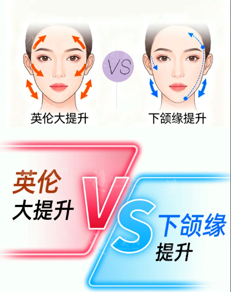 武漢藝星英倫大提升效果好嗎？朱勝軍醫(yī)生技術(shù)價格全揭秘