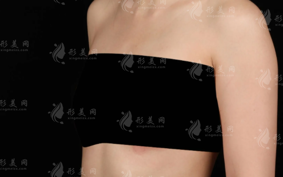 乳房再造哪里技術(shù)好？2026國內(nèi)權(quán)威醫(yī)院排名前十推薦