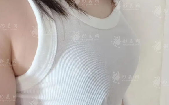 幸蘊無痕豐胸靠譜嗎？效果/價格/維持時間全解析