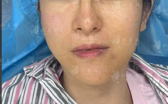 上海王洪醫(yī)生靠譜嗎?生長因子奧美定修復技術全揭秘