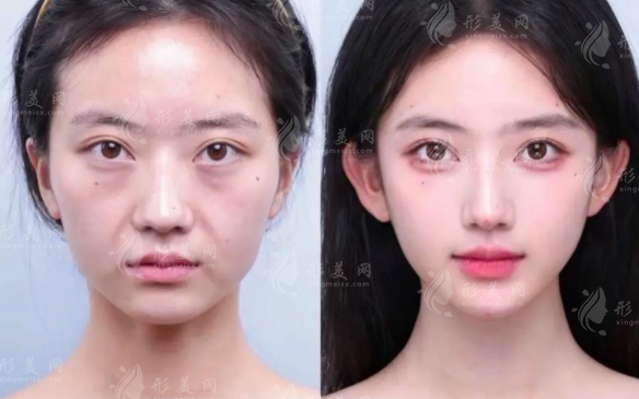 上海幼態(tài)臉醫(yī)生排名2026，郭敬松申濤聶婕技術(shù)解析