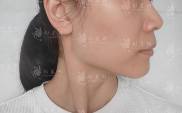 廣州磨骨醫(yī)院哪家好?廣大、韓妃、紫馨資質(zhì)與專家實(shí)力對(duì)比