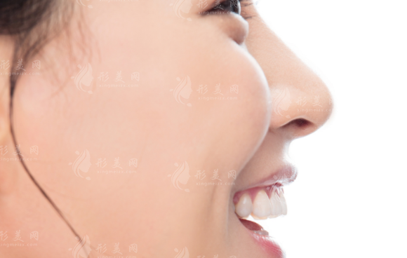 北京王曉健人中縮短術(shù)怎么樣?20年經(jīng)驗(yàn)+隱痕技術(shù)解析 北京王曉健人中縮短術(shù)怎么樣?20年經(jīng)驗(yàn)+隱痕技術(shù)解析
