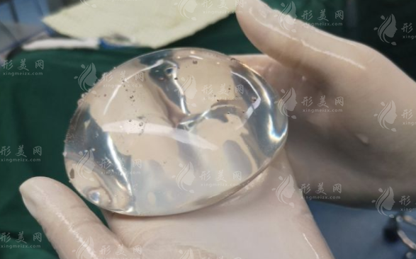 傲諾拉星熠假體型號(hào)全解析：選對(duì)不選貴，這份攻略請(qǐng)收好!