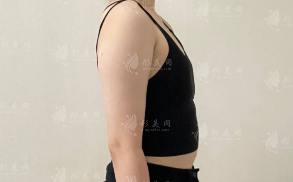 成都隆胸選哪家?后美薛瑞vs美萊熊猛技術(shù)審美大比拼