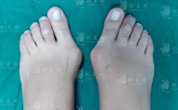 蘇敬達(dá)和馬桂文做大腳骨誰(shuí)好?技術(shù)風(fēng)格與價(jià)格全面對(duì)比