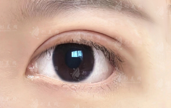 大連劉志剛眼修復(fù)口碑好嗎?20年經(jīng)驗+失敗修復(fù)價格全解析 大連劉志剛眼修復(fù)口碑好嗎?20年經(jīng)驗+失敗修復(fù)價格全解析