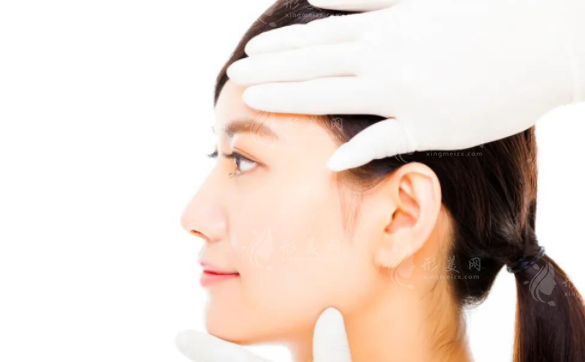 成鋌醫(yī)生技術(shù)怎么樣?聊城多美眼鼻胸吸脂項目實測