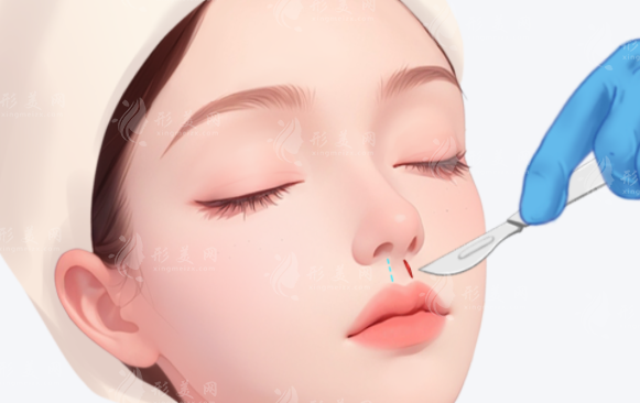 人中變平顯老怎么辦?口周抗衰正確思路別踩坑