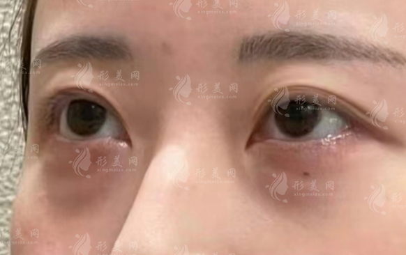 深圳眼修復(fù)醫(yī)生排名前十：經(jīng)驗足/高難度修復(fù)/口碑好閉眼入