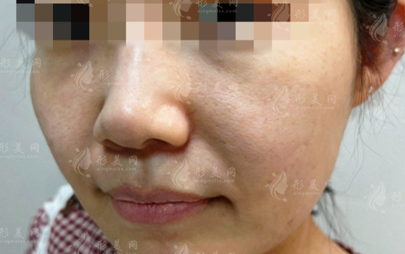 2026成都筋膜提升醫(yī)生排名榜：這四位技術(shù)靠譜口碑好