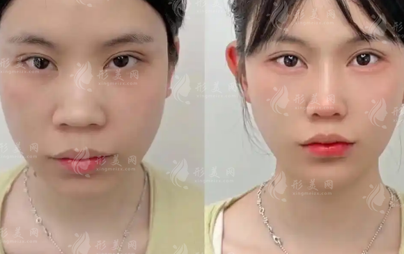 上海幼態(tài)臉打造醫(yī)生排名:十位技術(shù)大咖名單及坐診醫(yī)院盤點(diǎn) 上海幼態(tài)臉打造醫(yī)生排名:十位技術(shù)大咖名單及坐診醫(yī)院盤點(diǎn)