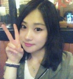 【磨骨瘦臉+墊鼻尖+眼部矯正】對比照 轉身就是氣質女神
