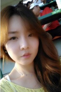 【隆鼻+面部脂肪移植】對比照 年輕十歲不是夢