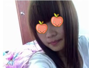 激光去痣 變美不是罪過(guò)