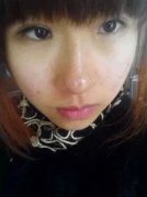 王者之心祛斑 + 嫩膚美白 跟斑揮揮手
