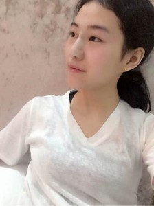 隆鼻手術(shù) 做更自信的自己