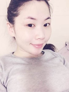 隆鼻+全切雙眼皮 美到無法呼吸 - 珍美網(wǎng)