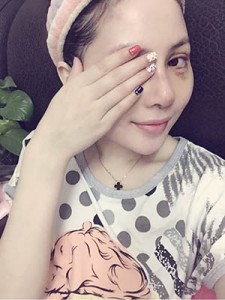 隆鼻+全切雙眼皮 美到無法呼吸 - 珍美網(wǎng)