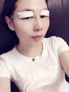 隆鼻+全切雙眼皮 美到無法呼吸 - 珍美網(wǎng)
