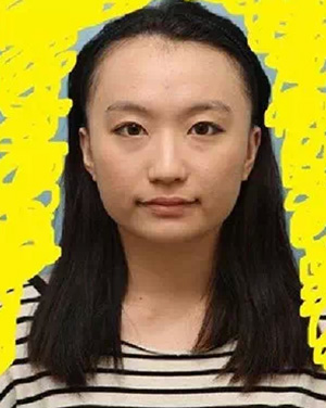 面部輪廓手術(shù) 讓你擁有完美臉型 - 珍美網(wǎng)