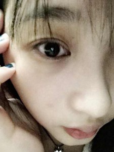 雙眼皮手術(shù) 讓自己更加甜美可愛 - 珍美網(wǎng)