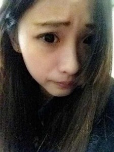 雙眼皮手術(shù) 讓自己更加甜美可愛 - 珍美網(wǎng)