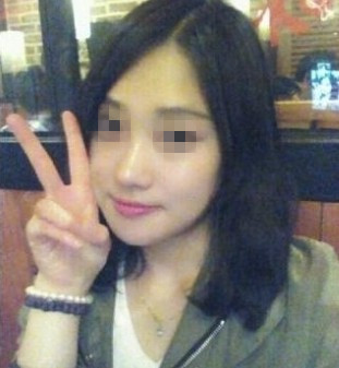 打肉毒素 大臉妹變小臉氣質美眉
