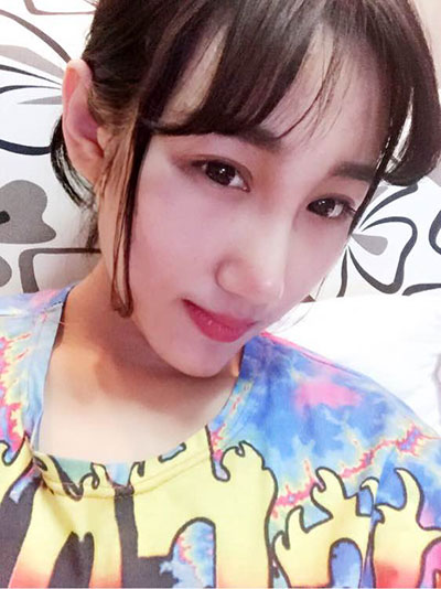 面部整形 逆襲的美讓人羨慕