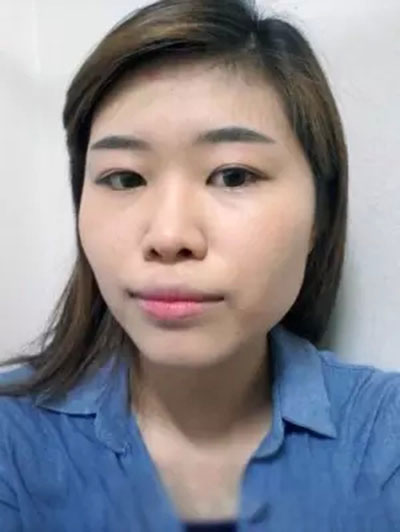 面部整形 從漢子變女神 - 珍美網(wǎng)