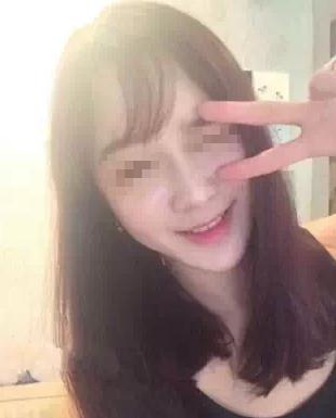 【玻尿酸填充淚溝+法令紋+豐蘋果肌】 變成靚麗的美眉 - 珍美網(wǎng)