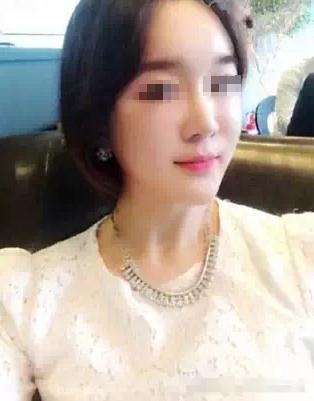 【玻尿酸填充淚溝+法令紋+豐蘋果肌】 變成靚麗的美眉 - 珍美網(wǎng)