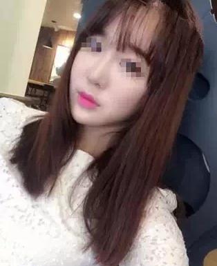 【玻尿酸填充淚溝+法令紋+豐蘋果肌】 變成靚麗的美眉